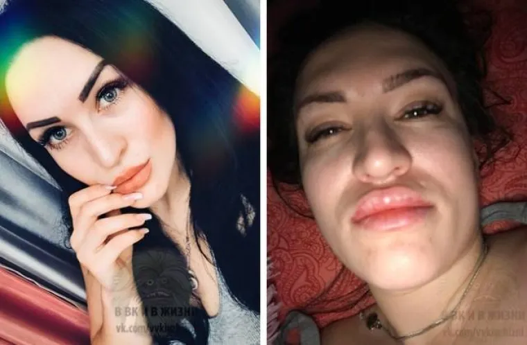 Djevojke iz galerije otkrile su svoje najmračnije tajne - kako uvijek ispadaju odlično na Instagramu. Na fotografijama su usporedile svoj svakodnevni izgled s fotografijama koje objavljuju na Instagramu, a ova razlika mogla bi šokirati mnoge. Neke od trikova kojima se služe da bi izgledale atraktivnije pogledajte u nastavku.