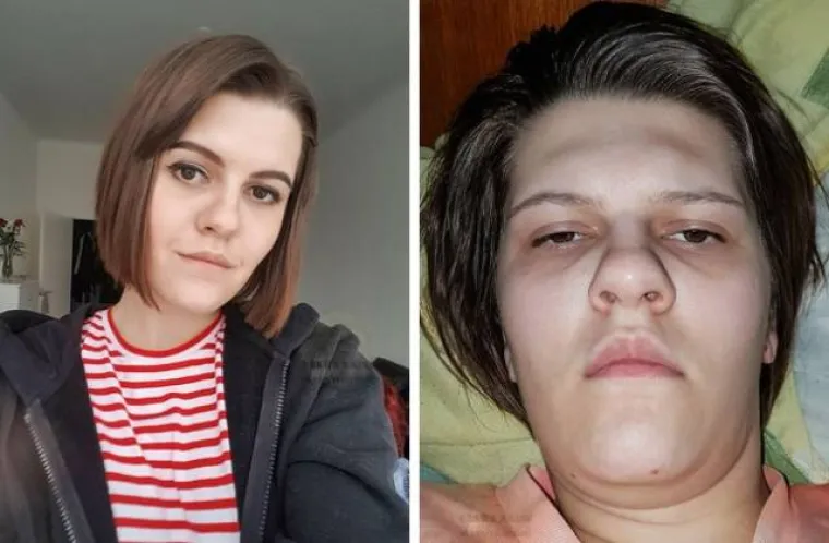 SVIMA RAZOTKRILE SVOJE TAJNE LJEPOTE: Pokazale kako od obične cure postati Instagram model