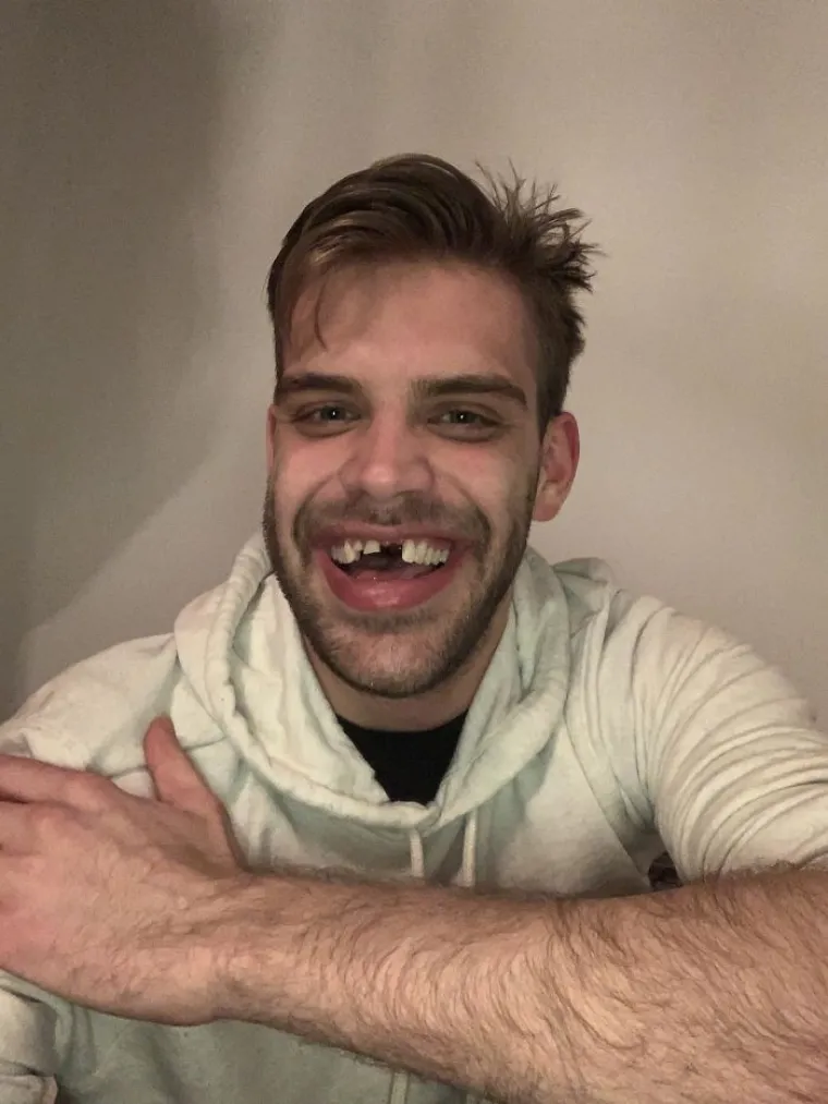 Bio sam naručen u dentalnu polikliniku  započeo niz zahvata, a onda nastupila karantena