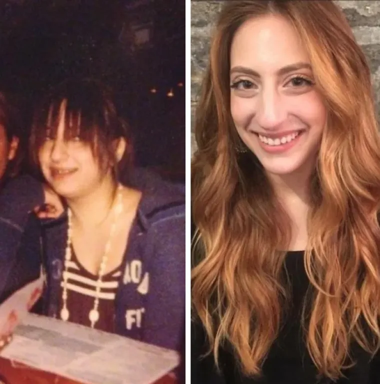 DOKAZ DA NITKO NIJE RUŽAN - SAMO JE JAKO, JAKO MLAD: Ovo su ljudi koji imaju puno razloga za pokazati slike prije i poslije