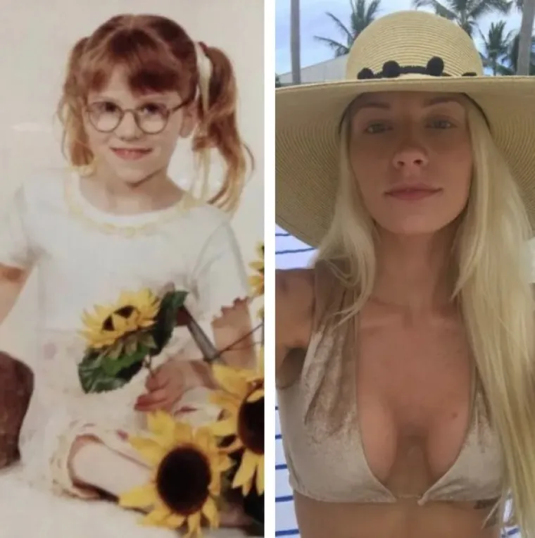 DOKAZ DA NITKO NIJE RUŽAN - SAMO JE JAKO, JAKO MLAD: Ovo su ljudi koji imaju puno razloga za pokazati slike prije i poslije