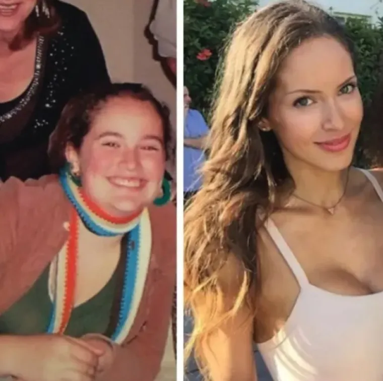 DOKAZ DA NITKO NIJE RUŽAN - SAMO JE JAKO, JAKO MLAD: Ovo su ljudi koji imaju puno razloga za pokazati slike prije i poslije