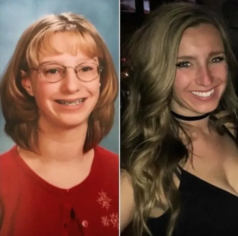 DOKAZ DA NITKO NIJE RUŽAN - SAMO JE JAKO, JAKO MLAD: Ovo su ljudi koji imaju puno razloga za pokazati slike prije i poslije