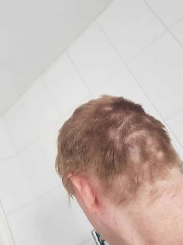 "Nikad više": Ove fotografije dokazuju da šišanje ipak trebamo prepustiti profesionalcima