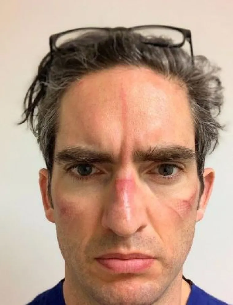 ''Ovo su lica borbe: umorna, ranjena, kao pregažena''