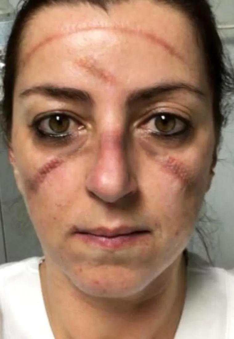 ''Ovo su lica borbe: umorna, ranjena, kao pregažena''