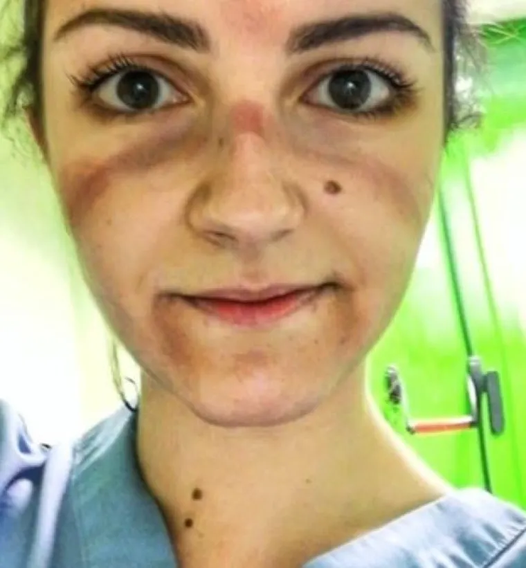 ''Ovo su lica borbe: umorna, ranjena, kao pregažena''