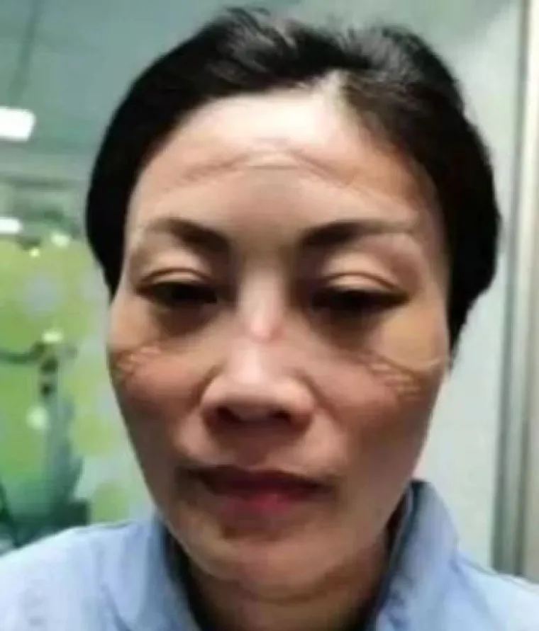 ''Ovo su lica borbe: umorna, ranjena, kao pregažena''