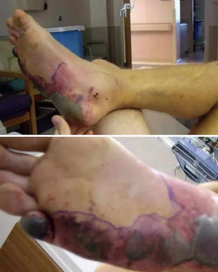 PRIRODA STVARNO ZNA BITI ODVRATNA: Ovakvi prizori ne viđaju se svaki dan - i neka tako ostane