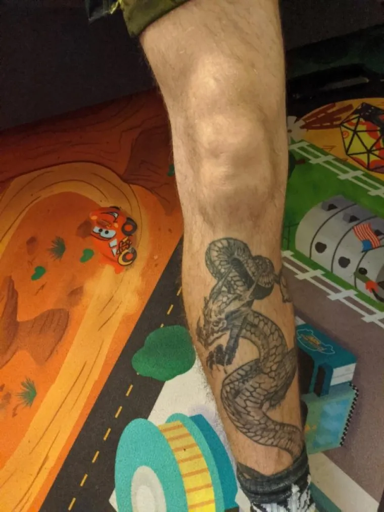 JESTE IKAD VIDJELI OVAKVO ŠTO? Ovo su koljena koja izgledaju kao da su u njima zarobljene - bebe