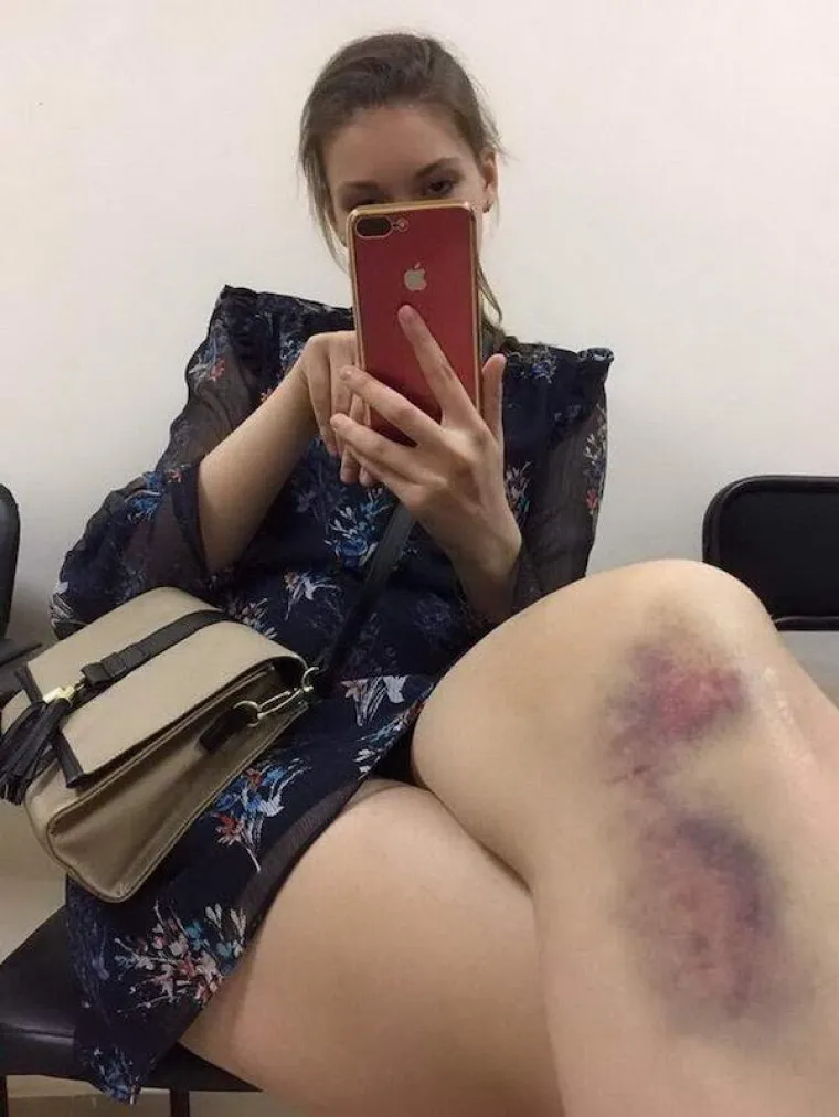 ŽIVI DOKAZI DA SE SRA** DOGAĐAJU BA&Scaron; SVIMA, A NE SAMO VAMA: 'E, ovo je definicija one poznate - 'Shit happens'