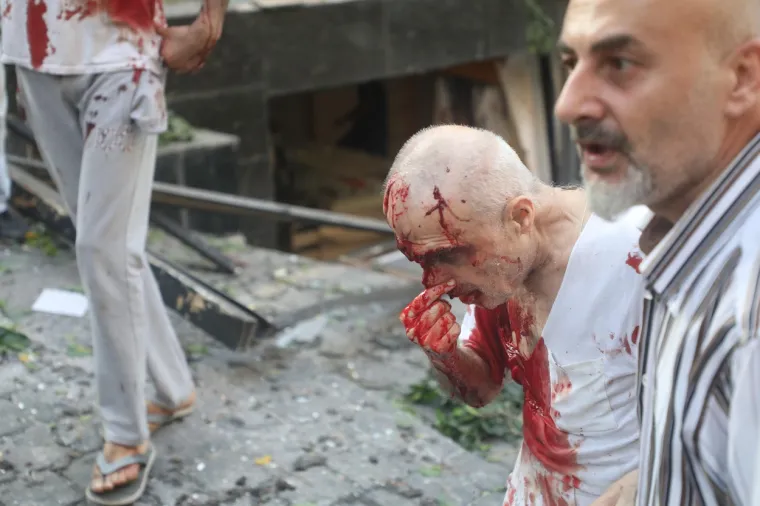 Stravični prizori iz Bejruta nakon eksplozije