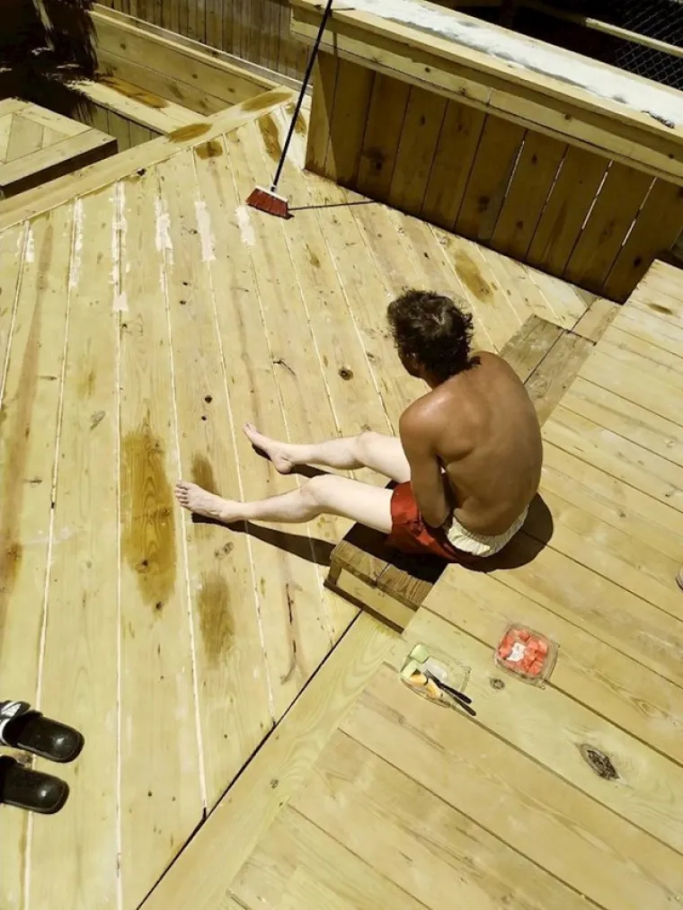 Zaspali pa 'izgorjeli': Ovi ljudi su požalili &scaron;to su zaboravili kremu za sunčanje