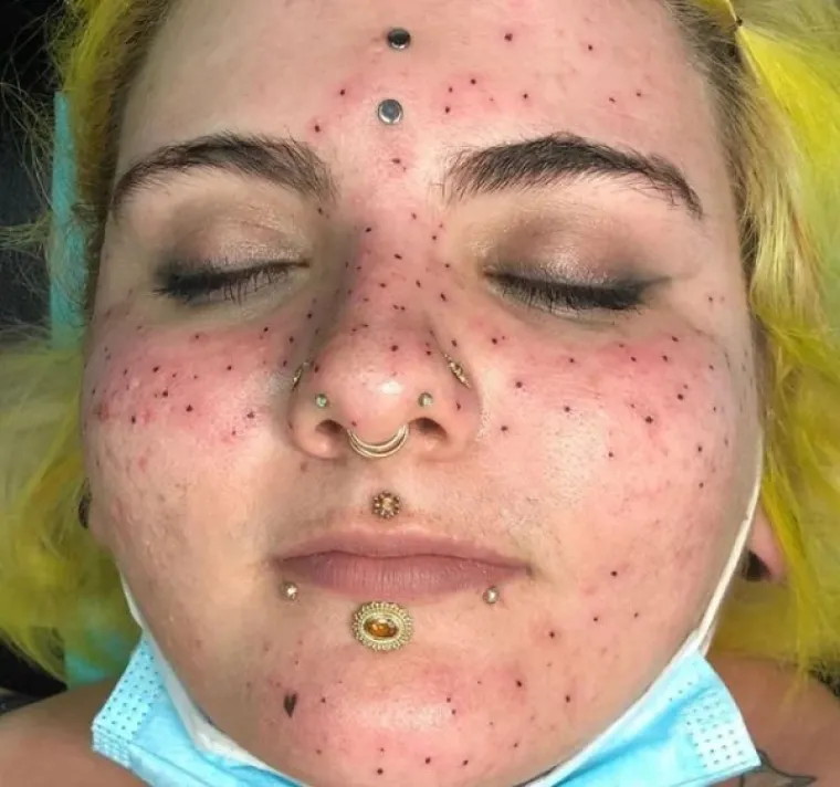 ZNALI SU DA SU TETOVAŽE TRAJNE, ALI SVEJEDNO SU ZAVRŠILI S OVIM GROZOTAMA: Teško je vjerovati da nisu požalili zbog ovih odabira