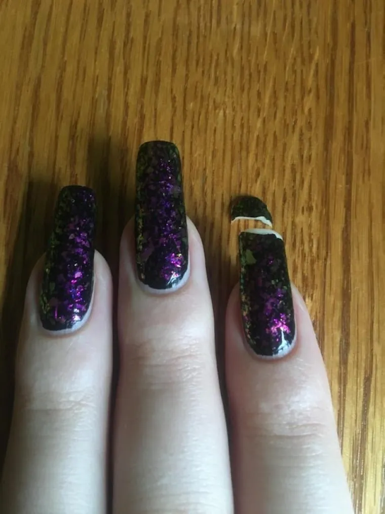 "Bila sam toliko gladna da sam uz krumpiriće odgrizla i dio svog nokta"