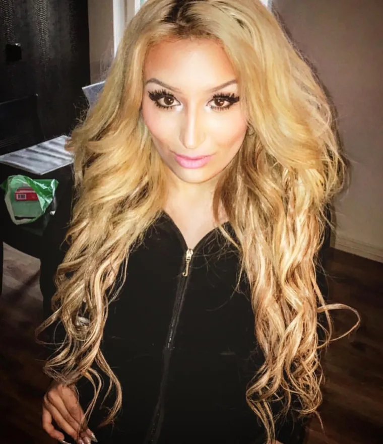 PRVE FILERE STAVILA JE SA SAMO 13 GODINA: Na estetske zahvate nagovorila ju je - vlastita majka. Već ih je napravila hrpu...