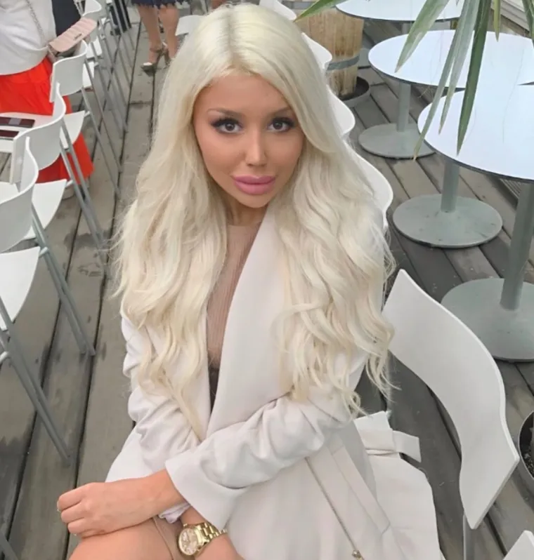 PRVE FILERE STAVILA JE SA SAMO 13 GODINA: Na estetske zahvate nagovorila ju je - vlastita majka. Već ih je napravila hrpu...