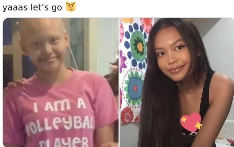 Najljep&scaron;i 'challenge' na svijetu: 'Prije i poslije' pobjede nad te&scaron;kom bolesti