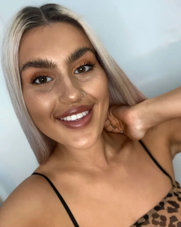 VIDITE LI NEŠTO NEOBIČNO NA OVOJ LJEPOTICI? Usprkos teškoj tjelesnoj mani, svi je uspoređuju s Kim Kardashian