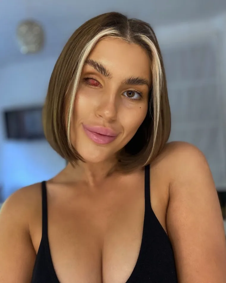 VIDITE LI NEŠTO NEOBIČNO NA OVOJ LJEPOTICI? Usprkos teškoj tjelesnoj mani, svi je uspoređuju s Kim Kardashian