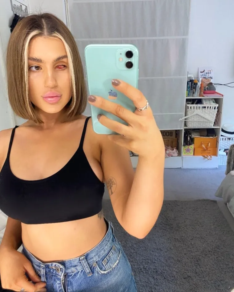 VIDITE LI NEŠTO NEOBIČNO NA OVOJ LJEPOTICI? Usprkos teškoj tjelesnoj mani, svi je uspoređuju s Kim Kardashian