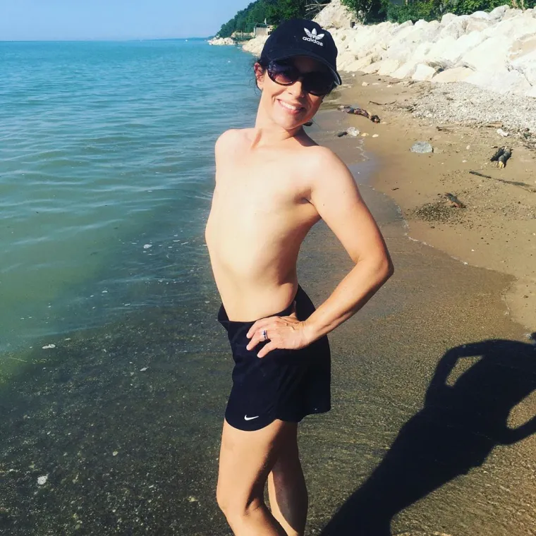 ZAR JE BEZ GRUDI MANJE ŽENSTVENA? Hrabra mama pozirala u toplesu nakon što su joj odstranili - obje dojke