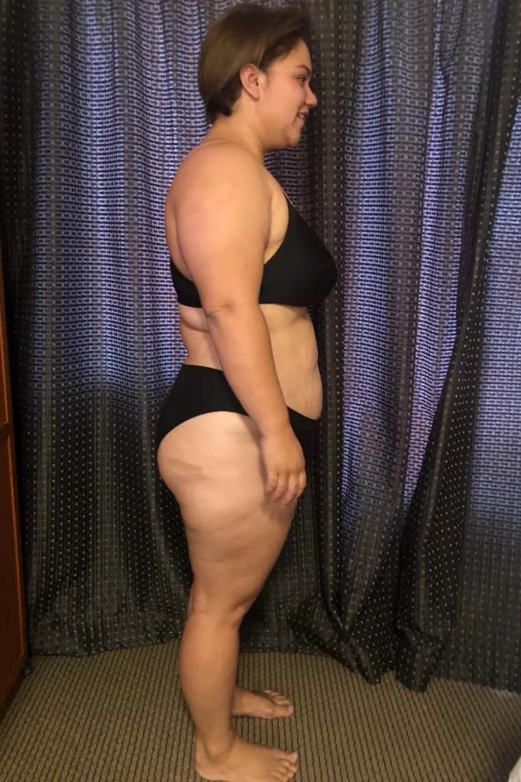 DJ Jarman (30) iz Hamiltona na Novom Zelandu odrasla je u obitelji koja je voljela hranu. S malo novca koji je mogla potro&scaron;iti na kvalitetne namirnice, DJ je od malih nogu razvila ovisnost o nezdravim grickalicama, jedući ogromne porcije čipsa, gaziranih pića, lizalica i čokolade u svakoj prilici.