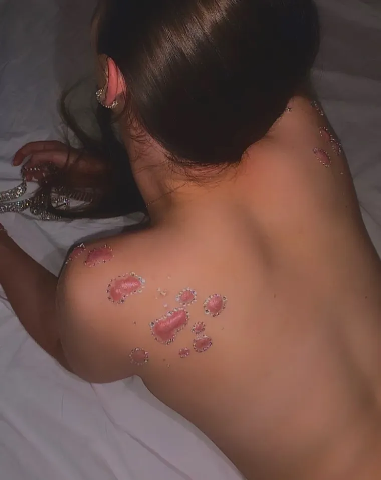 RUŽNE OŽILJKE PRETVORILA JE U UMJETNOST: Umjesto da ode pod nož, ova je djevojka zbog svoje ideje postala hit