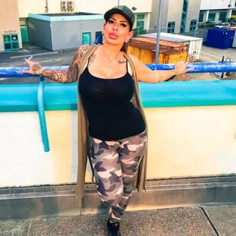 NAPUMPALE SE DO APSURDNIH RAZMJERA: Ne mogu zamisliti život bez silikona, pogledajte bizarne rezultate