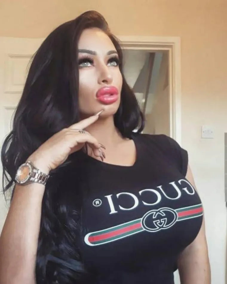 NAPUMPALE SE DO APSURDNIH RAZMJERA: Ne mogu zamisliti život bez silikona, pogledajte bizarne rezultate