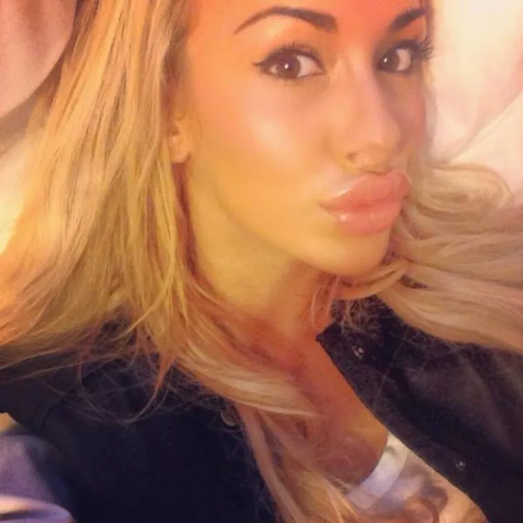 NAPUMPALE SE DO APSURDNIH RAZMJERA: Ne mogu zamisliti život bez silikona, pogledajte bizarne rezultate