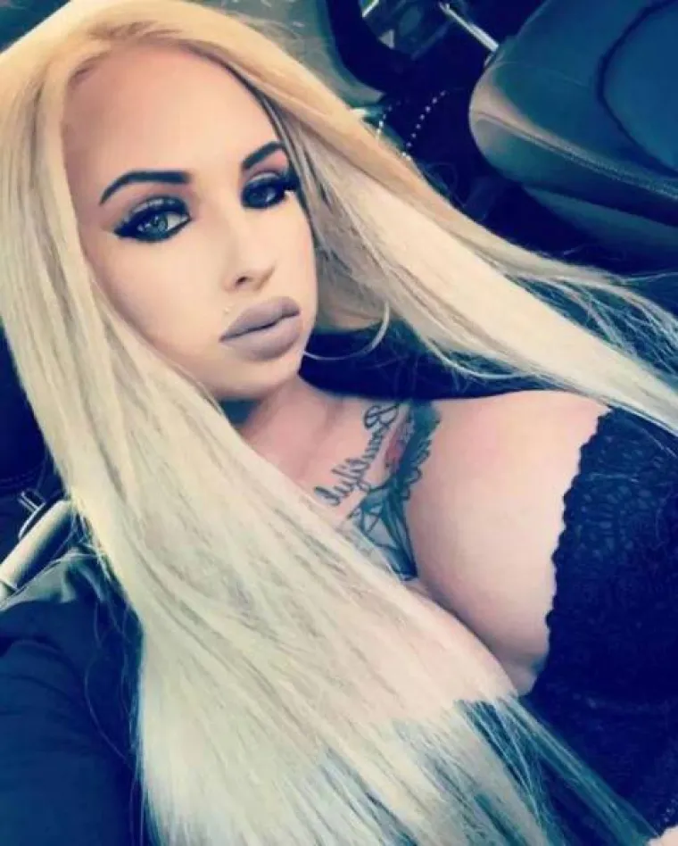 NAPUMPALE SE DO APSURDNIH RAZMJERA: Ne mogu zamisliti život bez silikona, pogledajte bizarne rezultate