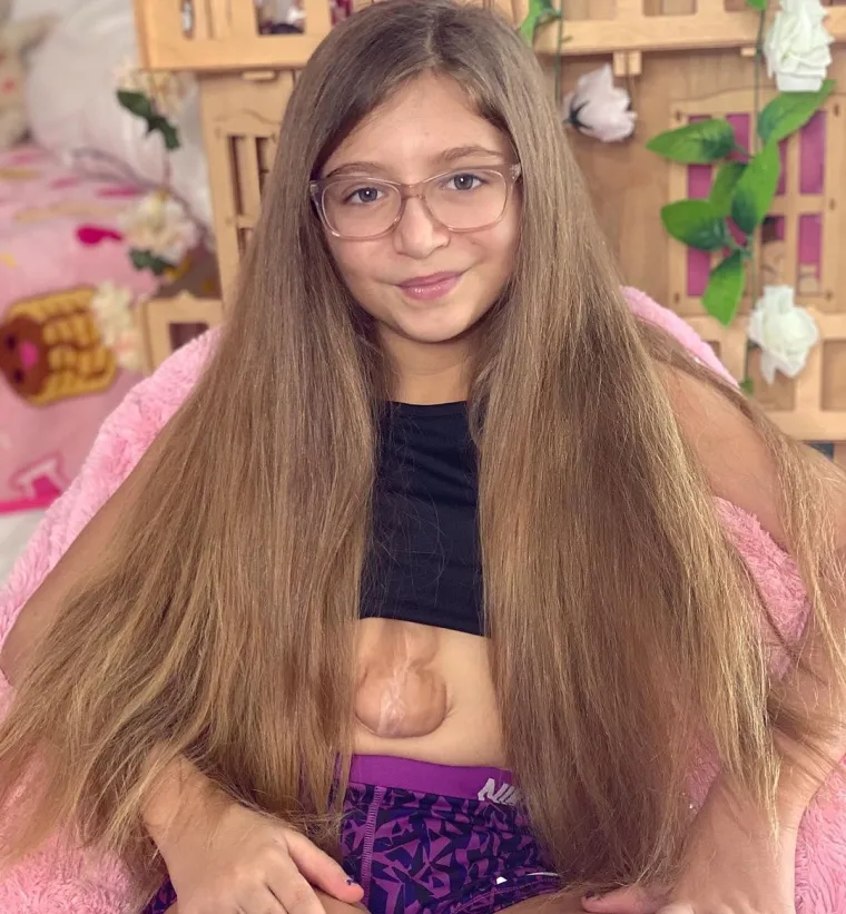 Virsaviya Borun-Goncharova (11) rođena je s rijetkim stanjem koje pogađa jednu od milijun beba. Njezino se srce, naime, razvilo izvan prsnoga koša.