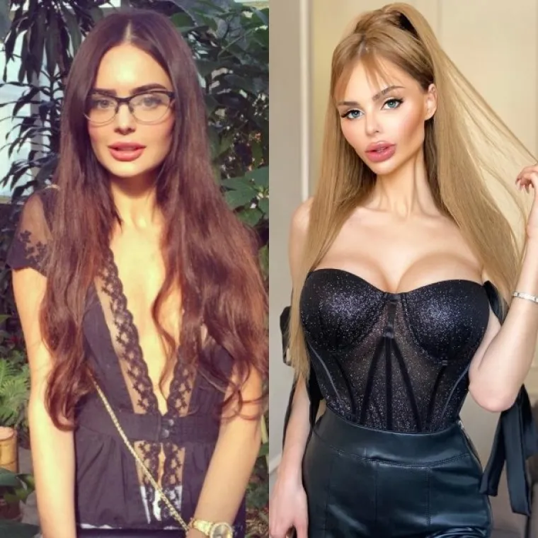 Ovisnici o plastici očito se vode idejom - 'više je više'