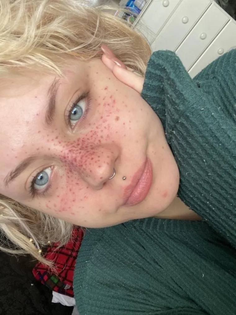 OKO TETOVAŽE JE IPAK DOBRO MALO PROMISLITI: No čini se da ovi nemaju elementarni preduvjet za to - zdrav razum