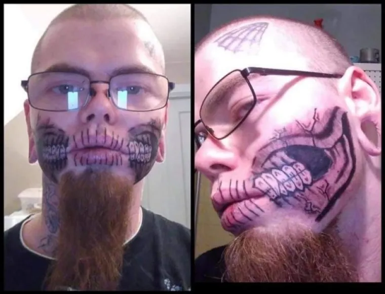 OKO TETOVAŽE JE IPAK DOBRO MALO PROMISLITI: No čini se da ovi nemaju elementarni preduvjet za to - zdrav razum