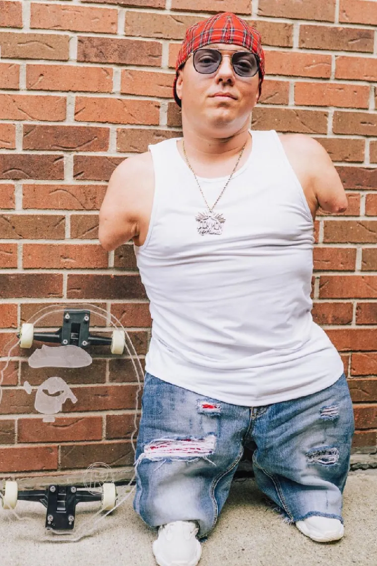 SVI SUPERHEROJI MOGU SE SAKRITI PRED NJIM: Rođen bez ruku te s nerazvijenim kukovima i nogama, a naučio je - voziti