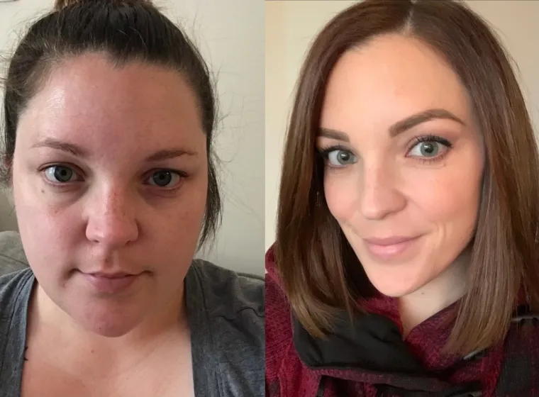 Nakon &scaron;to su ju bullyji u &scaron;koli brutalno vrijeđali zbog njene debljine, smr&scaron;avila je 45 kilograma. No sada joj na Instagramu poručuju daje premr&scaron;ava!