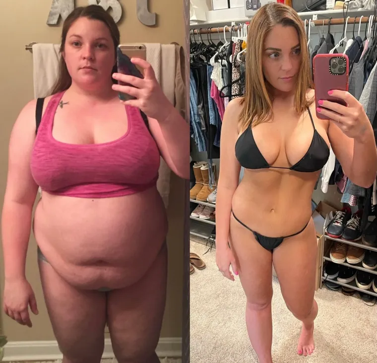 Kaže kako joj je gubitak kilograma potpuno promijenio život. Prije se nije mogla igrati sa svojom djecom ili hodati stubama, a da se ne osjeća iscrpljeno. Uvjerena je da ju je operacija učinila boljom mamom, suprugom i prijateljicom jer sada ima toliko vi&scaron;e energije. Voli planinariti, voziti bicikl, a čak i uči igrati golf. Karini prijatelji i obitelj primijetili su i ovu promjenu te kažu da ona ne samo da izgleda nevjerojatno, već je i toliko samopouzdanija od svoje operacije. Međutim, na Instagramu su se javili stranci koji joj poručuju da je sada premr&scaron;ava