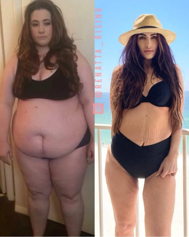 Naravno, to je dovelo do prekomjerne tjelesne težine, a u jednom trenutku vaga je u njezinu slučaju pokazivala čak 130 kilograma.