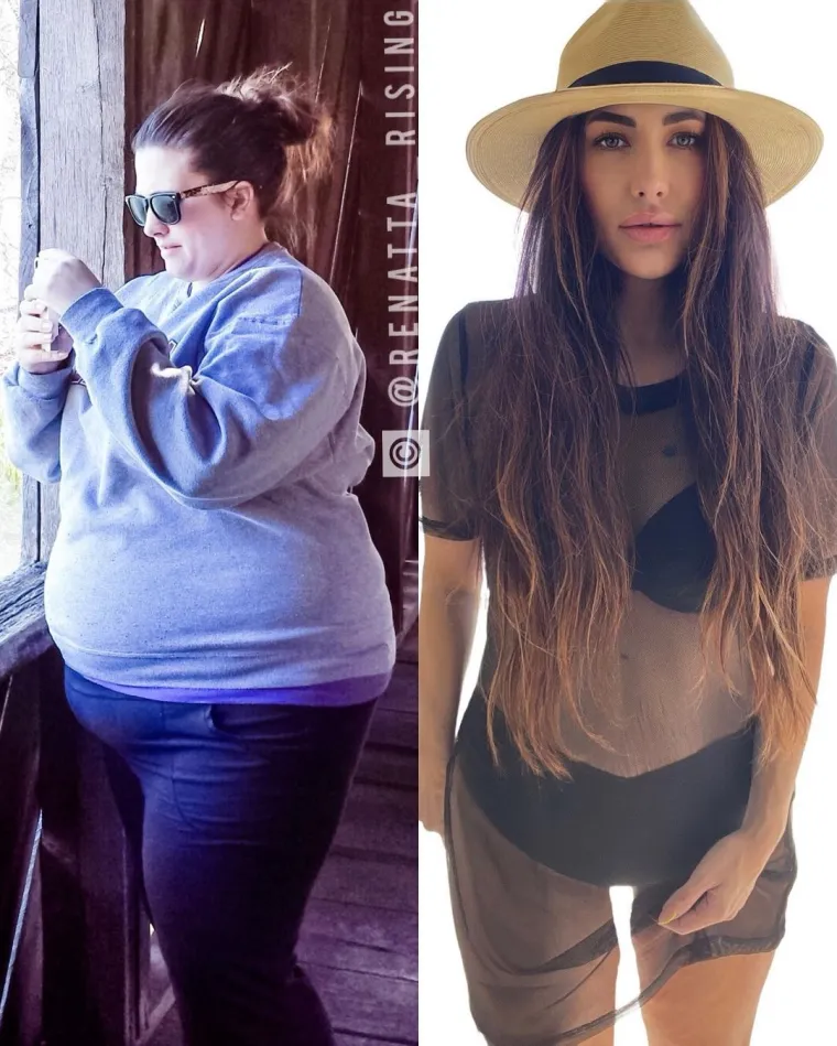 ONA JE JEDINICA ZA INSPIRACIJU: U ovako lijepu djevojku zaljubljuje se na prvi pogled, ali njezina priča je to &scaron;to će vas ostaviti paf!