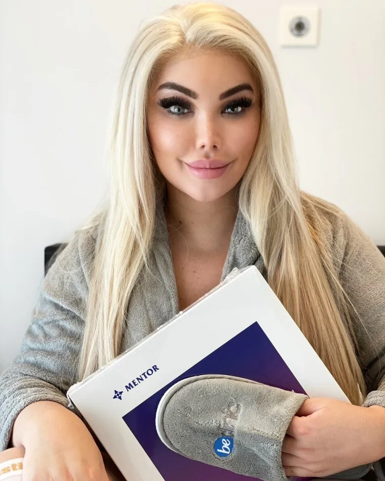 U posljednje vrijeme Jessica je često na meti kritičara koji joj poručuju kako je pretjerala i da bi trebala prestati s plastičnim operacijama. FOTO: Profimedia