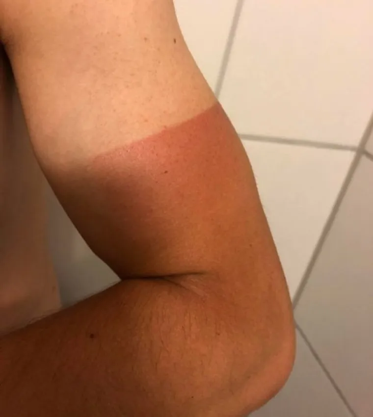 Ma ne treba nam krema; Sad im je 'malo' žao...