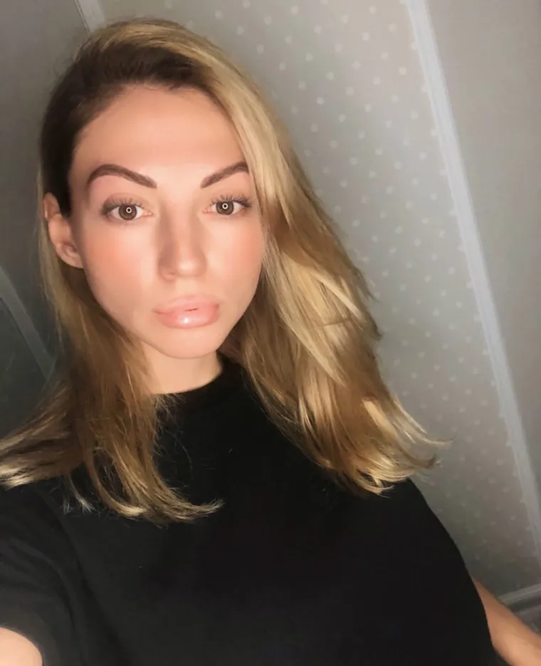 Marina (31) je umrla tijekom banalne korekcije nosa: Objavljena snimka iz operacijske sale, kirurzima prijeti zatvor!