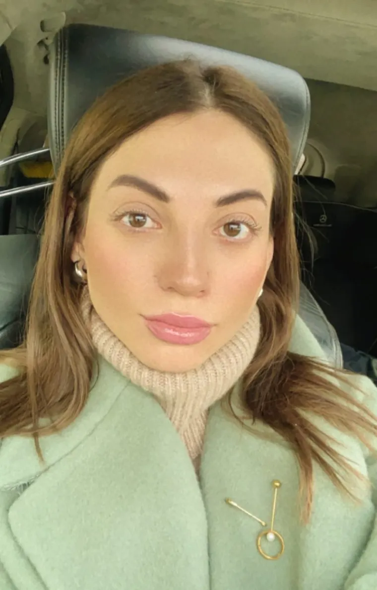 Marina (31) je umrla tijekom banalne korekcije nosa: Objavljena snimka iz operacijske sale, kirurzima prijeti zatvor!