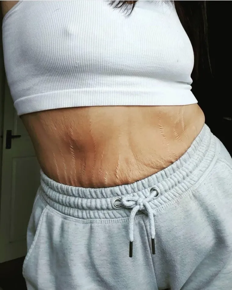 U samo 11 mjeseci izgubila je čak 45 kilograma! Lice joj se potpuno promijenilo - ali čekajte da vidite tijelo...