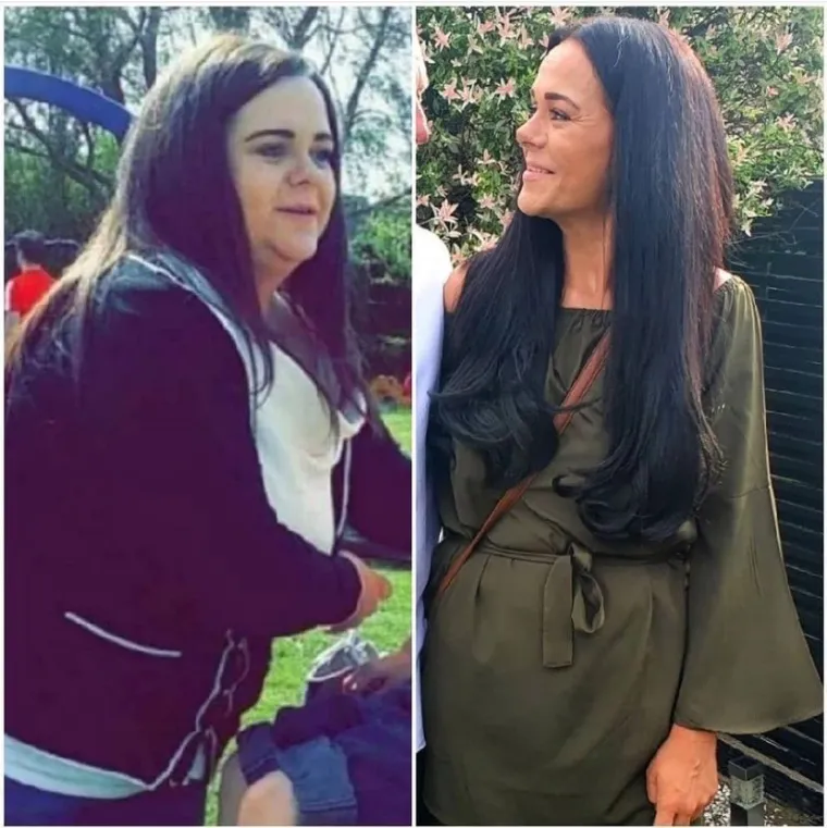 U samo 11 mjeseci izgubila je čak 45 kilograma! Lice joj se potpuno promijenilo - ali čekajte da vidite tijelo...