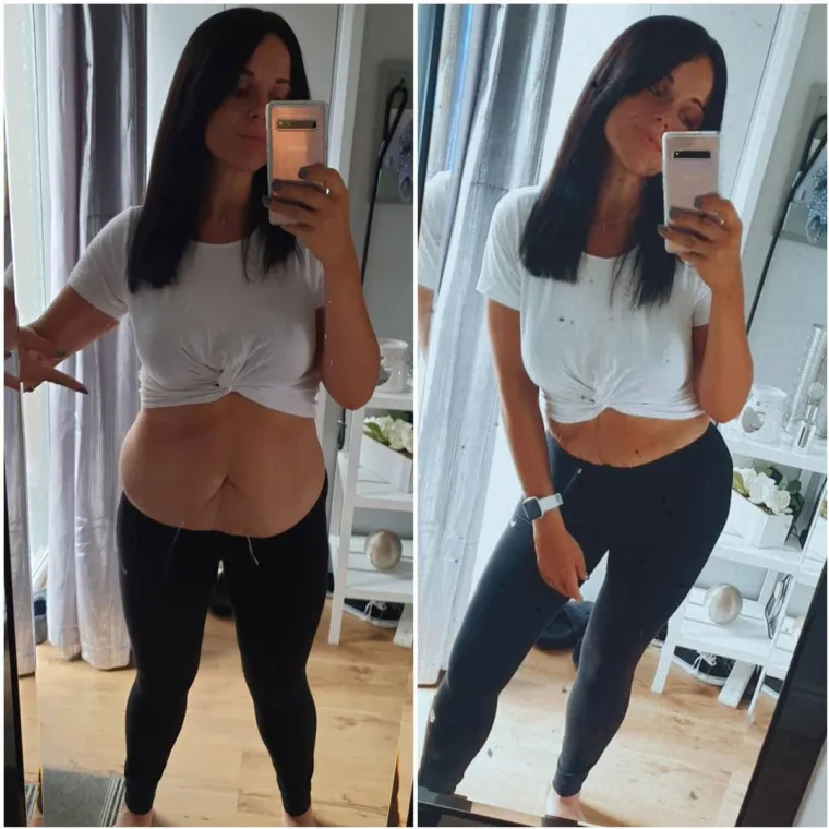 U samo 11 mjeseci izgubila je čak 45 kilograma! Lice joj se potpuno promijenilo - ali čekajte da vidite tijelo...