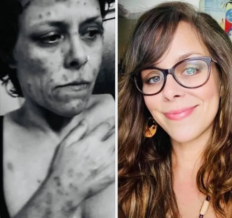 Otele su se zagrljaju smrti, pobijedile svoje demone i danas svaka od njih ponovno izgleda poput prelijepe princeze