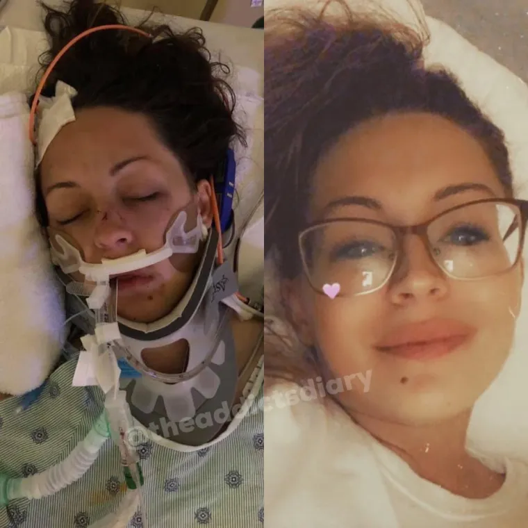 Otele su se zagrljaju smrti, pobijedile svoje demone i danas svaka od njih ponovno izgleda poput prelijepe princeze